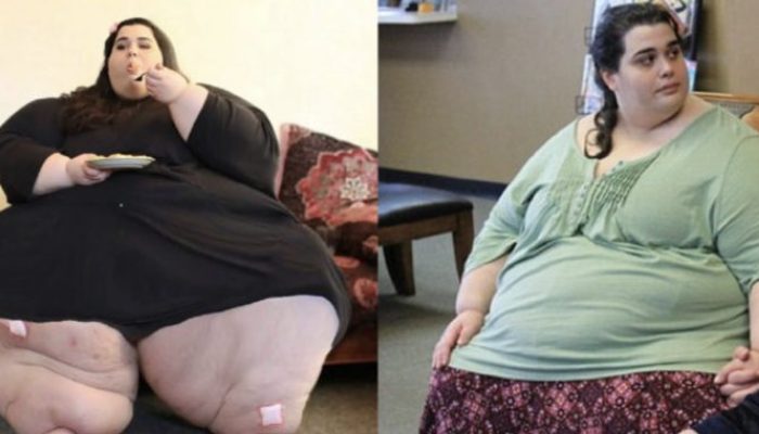 Totally amazing change. The woman who formerly weighed 300 pounds